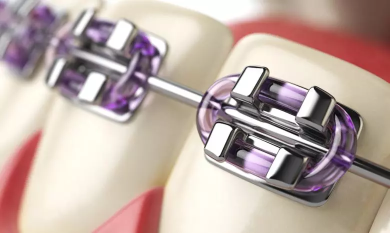 Ortodonti - Özel Coşkun Ağız ve Diş Sağlığı Polikliniği