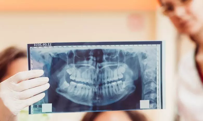 Panoramik Röntgen - Özel Coşkun Ağız ve Diş Sağlığı Polikliniği