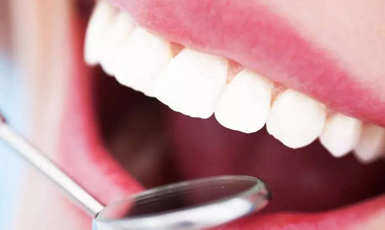 Porselen Laminalar - Özel Coşkun Ağız ve Diş Sağlığı Polikliniği